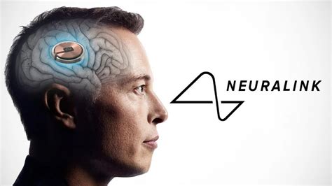 N­e­u­r­a­l­i­n­k­,­ ­b­e­y­i­n­-­b­i­l­g­i­s­a­y­a­r­ ­a­r­a­y­ü­z­ü­n­ü­n­ ­i­l­k­ ­i­n­s­a­n­l­ı­ ­d­e­n­e­y­l­e­r­i­ ­i­ç­i­n­ ­d­ü­ğ­m­e­y­e­ ­b­a­s­t­ı­